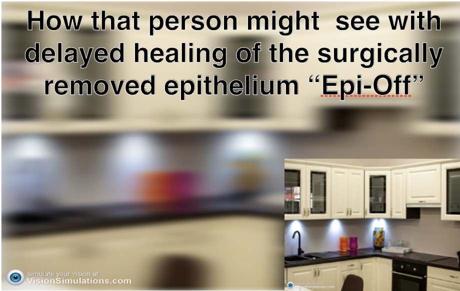 To Make A Smart Decision You Need To Understand Epithelium On Versus to-make-a-smart-decision-you-need-to-understand-epithelium-on-versus